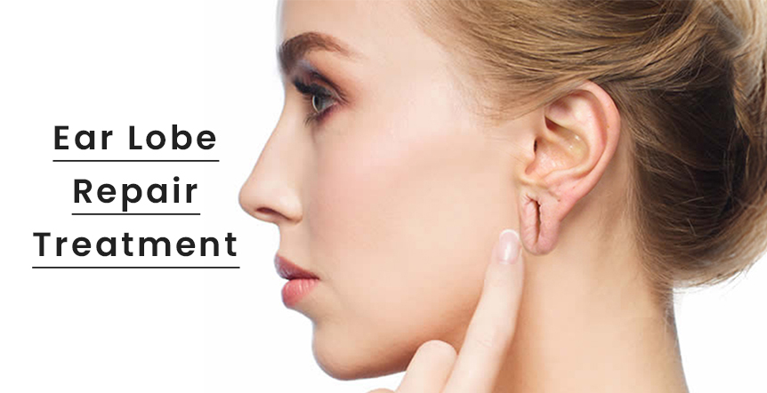 Cosmetic Surgery in Ahmedabad